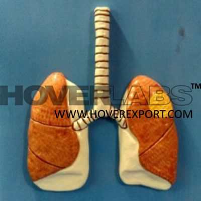 T.B.肺模型的动态