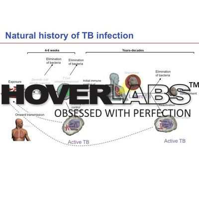 T.B.Infection模型