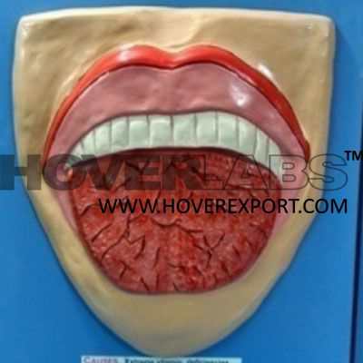 角性口炎舌炎模型